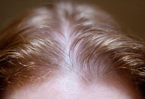 علل و درمان نازک شدن مو